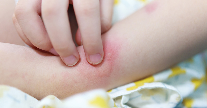 កន្ទាលត្រអាកជាអ្វី? ហេតុអ្វីក្មេងឡើងកន្ទាលត្រអាក?